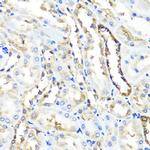 HYAL1 Antibody in Immunohistochemistry (Paraffin) (IHC (P))