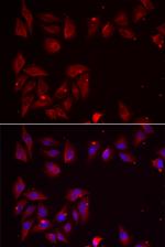 PDXK Antibody in Immunocytochemistry (ICC/IF)