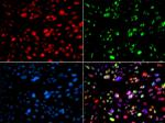 PNK Antibody in Immunocytochemistry (ICC/IF)