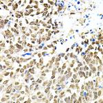 PNK Antibody in Immunohistochemistry (Paraffin) (IHC (P))