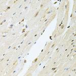 PNK Antibody in Immunohistochemistry (Paraffin) (IHC (P))