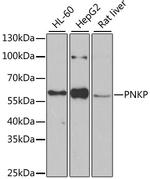 PNK Antibody in Western Blot (WB)