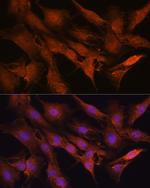 PPM1A Antibody in Immunocytochemistry (ICC/IF)