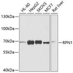 Ribophorin I Antibody in Western Blot (WB)