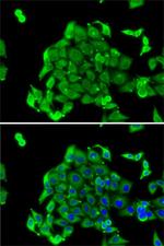 RPS14 Antibody in Immunocytochemistry (ICC/IF)