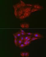 Rhotekin Antibody in Immunocytochemistry (ICC/IF)