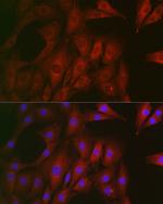 Rhotekin Antibody in Immunocytochemistry (ICC/IF)