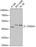 ST8SIA4 Antibody in Western Blot (WB)