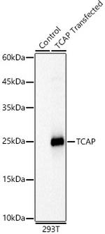 TCAP Antibody in Western Blot (WB)