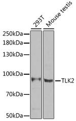 TLK2 Antibody in Western Blot (WB)