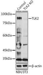 TLK2 Antibody in Western Blot (WB)