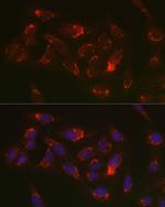 Thioredoxin 2 Antibody in Immunocytochemistry (ICC/IF)