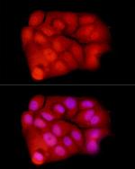 XPO5 Antibody in Immunocytochemistry (ICC/IF)