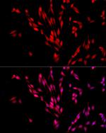 XPO5 Antibody in Immunocytochemistry (ICC/IF)