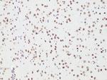 BCL9 Antibody in Immunohistochemistry (Paraffin) (IHC (P))