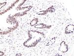 BCL9 Antibody in Immunohistochemistry (Paraffin) (IHC (P))