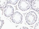 BCL9 Antibody in Immunohistochemistry (Paraffin) (IHC (P))