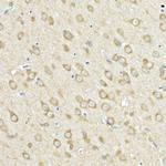 ACSL4 Antibody in Immunohistochemistry (Paraffin) (IHC (P))