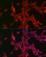 ALOX15B Antibody in Immunocytochemistry (ICC/IF)