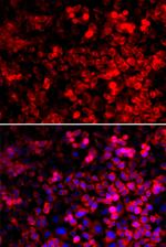 QARS Antibody in Immunocytochemistry (ICC/IF)