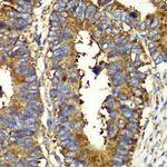 QARS Antibody in Immunohistochemistry (Paraffin) (IHC (P))