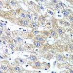 QARS Antibody in Immunohistochemistry (Paraffin) (IHC (P))