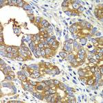 QARS Antibody in Immunohistochemistry (Paraffin) (IHC (P))