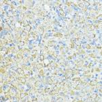 SOD3 Antibody in Immunohistochemistry (Paraffin) (IHC (P))