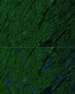 Cardiac Troponin I Antibody in Immunocytochemistry (ICC/IF)