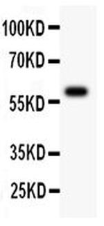 ATM Antibody in Western Blot (WB)