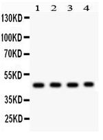 MBD2 Antibody in Western Blot (WB)