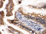 H-Ras Antibody in Immunohistochemistry (Paraffin) (IHC (P))