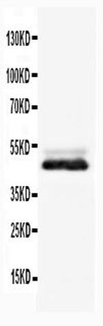 NSE Antibody in Western Blot (WB)