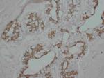 PKC alpha Antibody in Immunohistochemistry (Paraffin) (IHC (P))