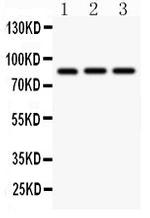 CD18 Antibody in Western Blot (WB)