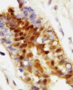 HSC70 Antibody in Immunohistochemistry (Paraffin) (IHC (P))