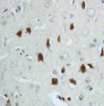 HSC70 Antibody in Immunohistochemistry (Paraffin) (IHC (P))