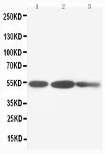 Cytokeratin 8 Antibody in Western Blot (WB)