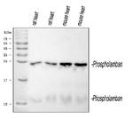 Phospholamban Antibody in Western Blot (WB)