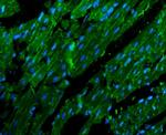 N-cadherin Antibody in Immunohistochemistry (Paraffin) (IHC (P))