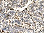 N-cadherin Antibody in Immunohistochemistry (Paraffin) (IHC (P))