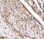 N-cadherin Antibody in Immunohistochemistry (Paraffin) (IHC (P))