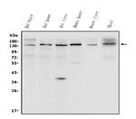 N-cadherin Antibody in Western Blot (WB)