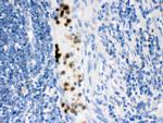 FABP3 Antibody in Immunohistochemistry (Paraffin) (IHC (P))