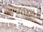 FABP3 Antibody in Immunohistochemistry (Paraffin) (IHC (P))