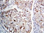 MEK1 Antibody in Immunohistochemistry (Paraffin) (IHC (P))