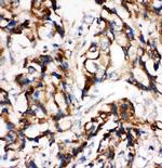 MEK1 Antibody in Immunohistochemistry (Paraffin) (IHC (P))