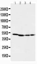 MEK1 Antibody in Western Blot (WB)