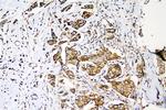 MEK3 Antibody in Immunohistochemistry (Paraffin) (IHC (P))