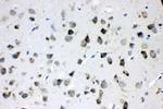 MEK3 Antibody in Immunohistochemistry (Paraffin) (IHC (P))